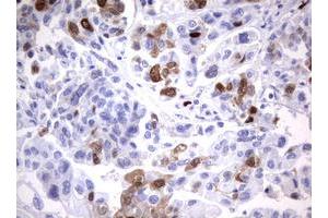 Image no. 2 for anti-Thymidylate Synthetase (TYMS) antibody (ABIN1501595)