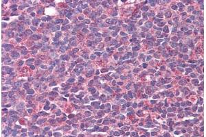 Human Tonsil: Formalin-Fixed, Paraffin-Embedded (FFPE) (CAMK2B anticorps  (AA 1-504))