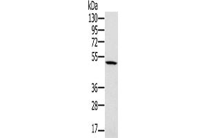 Western Blotting (WB) image for anti-Proteasome (Prosome, Macropain) 26S Subunit, ATPase, 2 (PSMC2) antibody (ABIN2423817)