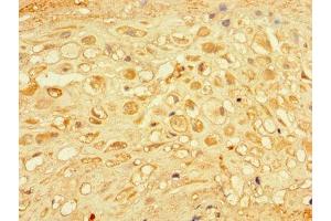 Immunohistochemistry of paraffin-embedded human placenta tissue using ABIN7166973 at dilution of 1:100