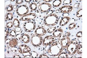 Immunohistochemical staining of paraffin-embedded Human Kidney tissue using anti-TBXAS1 mouse monoclonal antibody. (TBXAS1 anticorps)
