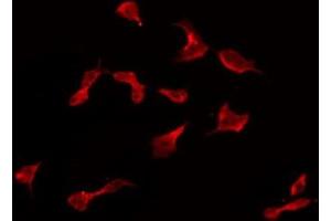 ABIN6274972 staining HeLa by IF/ICC.