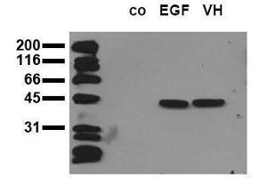 Western Blotting (WB) image for anti-Mitogen-Activated Protein Kinase 3 (MAPK3) (pThr-Glu-pTyr) antibody (ABIN126831) (ERK1 anticorps  (pThr-Glu-pTyr))