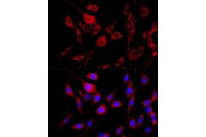 Immunofluorescence analysis of PC-12 cells using FGFR2 antibody (ABIN6130457, ABIN6140615, ABIN6140617 and ABIN6216059) at dilution of 1:100 (40x lens).