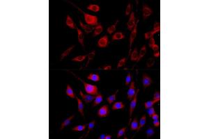 Immunofluorescence analysis of PC-12 cells using FGFR2 antibody (ABIN6130457, ABIN6140615, ABIN6140617 and ABIN6216059) at dilution of 1:100 (40x lens). (FGFR2 anticorps  (AA 245-345))