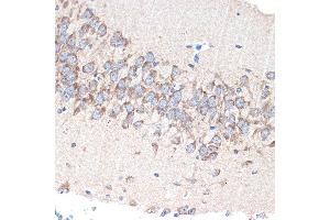 Immunohistochemistry of paraffin-embedded mouse brain using P Rabbit mAb (ABIN7269161) at dilution of 1:100 (40x lens).