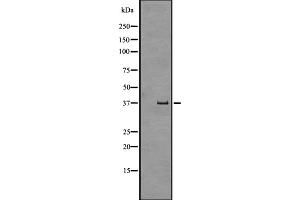 Western blot analysis of GPR43 expression in Human fetal liver lysate ,The lane on the left is treated with the antigen-specific peptide.