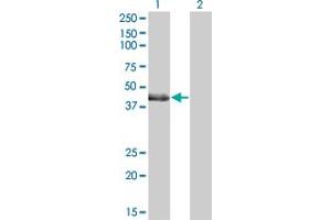 Western Blot analysis of LMCD1 expression in transfected 293T cell line by LMCD1 polyclonal antibody (A01). (LMCD1 anticorps  (AA 266-364))