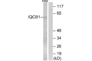 Western blot analysis of extracts from K562 cells, using IQCB1 antibody. (IQCB1 anticorps)