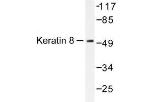 Image no. 1 for anti-Keratin 8 (KRT8) antibody (ABIN265504) (KRT8 anticorps)
