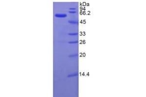 SDS-PAGE analysis of Rat ITIH4 Protein.