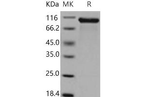Western Blotting (WB) image for Receptor tyrosine-protein kinase erbB-2 (ErbB2/Her2) (AA 4-656) protein (His tag) (ABIN7321222)
