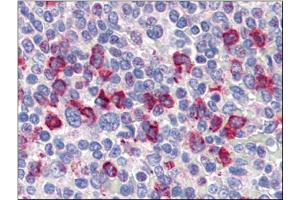 Human Spleen (formalin-fixed, paraffin-embedded) stained with CD14at 4 µg/ml followed by biotinylated anti-goat IgG secondary antibody, alkaline phosphatase-streptavidin and chromogen. (CD14 anticorps)
