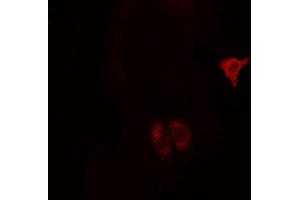 ABIN6268685 staining MCF7 cells by ICC/IF. (CD9 anticorps  (Internal Region))