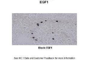 Sample Type :  Frog brain  Primary Antibody Dilution :  1:500  Secondary Antibody :  Biotinylated goat anti-rabbit  Secondary Antibody Dilution :  1:200  Color/Signal Descriptions :  Black: EGF1  Gene Name :  EGR1 a  Submitted by :  Eva Fischer, Colorado State University