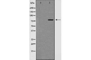 Western blot analysis of Cyclin F expression in extracts from HeLa cells. (Cyclin F anticorps  (C-Term))