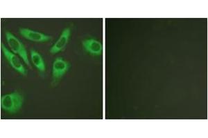 Immunofluorescence analysis of HeLa cells, using S6 Ribosomal Protein (Ab-240) Antibody. (RPS6 anticorps  (AA 191-240))