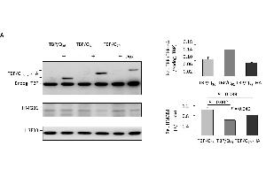 HMGB1 dysfunction in TBP/Q61~79 SH-SY5Y cells and the associated neuronal phenotype. (Histone H3.3B anticorps  (full length))