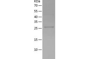 Western Blotting (WB) image for Cell Division Cycle Associated 8 (CDCA8) (AA 19-280) protein (His-IF2DI Tag) (ABIN7122232)