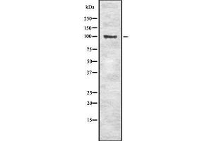 Western blot analysis of SLC4A1 using RAW264. (Band 3/AE1 anticorps  (Internal Region))