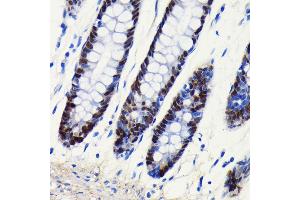 Immunohistochemistry of paraffin-embedded human colon using SOX9 antibody (ABIN7270577) at dilution of 1:100 (40x lens). (SOX9 anticorps)
