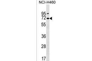 PKD2L2 Antibody (Center) (ABIN1538023 and ABIN2850127) western blot analysis in NCI- cell line lysates (35 μg/lane). (PKD2L2 anticorps  (AA 193-219))