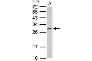 WB Image Proteasome 20S alpha 6 antibody detects PSMA6 protein by Western blot analysis. (PSMA6 anticorps  (Center))