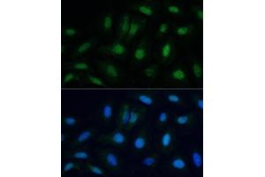 Immunofluorescence analysis of U-2 OS cells using ETS2 antibody (ABIN6133259, ABIN6140325, ABIN6140326 and ABIN6223170) at dilution of 1:100.