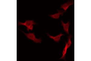 ABIN6266537 staining 293 by IF/ICC. (FASL anticorps  (Internal Region))