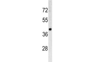 Western blot analysis of TROP2 antibody and HL-60 lysate.