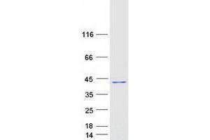 Validation with Western Blot