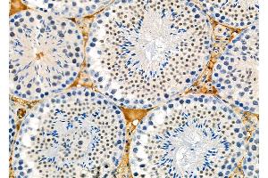 ABIN6261407 and ABIN6273114 at 1/100 staining Mouse testis tissue by IHC-P. (DYX1C1 anticorps  (Internal Region))