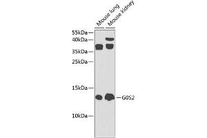 Western blot analysis of extracts of various cell lines, using G0S2 Antibody (ABIN6134775, ABIN6140856, ABIN6140858 and ABIN6225312) at 1:1000 dilution. (G0S2 anticorps  (AA 1-100))