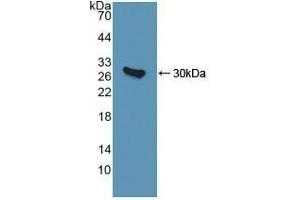 Detection of Recombinant QDPR, Human using Polyclonal Antibody to Quinoid Dihydropteridine Reductase (QDPR) (QDPR anticorps  (AA 1-244))