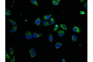 Immunofluorescence staining of Hela cells with ABIN7159440 at 1:50, counter-stained with DAPI. (Metabotropic Glutamate Receptor 3 anticorps  (AA 46-354))
