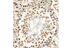 Immunohistochemistry of paraffin embedded mouse testis using CDY1 (ABIN7073493) at dilution of 1:400 (400x lens)