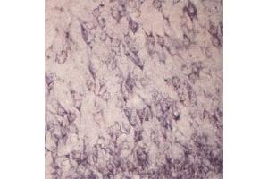 IHC on rat brain using Rabbit antibody to extracellular, N-terminal part of Sortilin (Neurotensin receptor 3, NTR3, Sort1): IgG  at a concentration of 10 µg/ml. (Sortilin 1 anticorps)