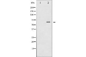 Western blot analysis of SYK phosphorylation expression in EGF treated COS7 whole cell lysates,The lane on the left is treated with the antigen-specific peptide.