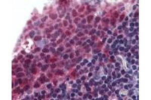 Immunohistochemistry (IHC) image for anti-Tumor Necrosis Factor (Ligand) Superfamily, Member 13b (TNFSF13B) (AA 254-269) antibody (ABIN2470160)