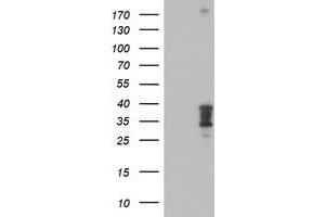 Western Blotting (WB) image for anti-Homeobox C11 (HOXC11) (AA 1-304) antibody (ABIN1490735) (HOXC11 anticorps  (AA 1-304))