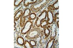 Immunohistochemistry analysis in formalin fixed and paraffin embedded human kidney tissue reacted with NDUFC2 Antibody (C-term) followed which was peroxidase conjugated to the secondary antibody and followed by DAB staining.