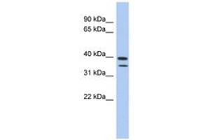 Image no. 1 for anti-Methyltransferase Like 19 (METTL19) (AA 427-476) antibody (ABIN6743698) (C4ORF23 anticorps  (AA 427-476))