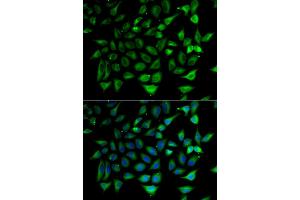 Immunofluorescence analysis of HeLa cells using SLC25A20 antibody (ABIN5974144). (SLC25A20 anticorps)
