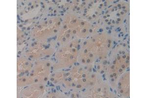 IHC-P analysis of kidney tissue, with DAB staining. (CDK2AP1 anticorps  (AA 1-115))