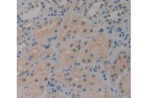 IHC-P analysis of kidney tissue, with DAB staining. (CDK2AP1 anticorps  (AA 1-115))