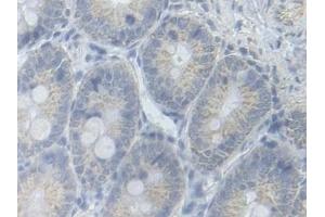 Detection of PFKM in Rat Colon Tissue using Polyclonal Antibody to Phosphofructokinase, Muscle (PFKM)