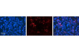 NOMO1 antibody - C-terminal region (ARP54998_P050) Catalog Number: ARP54998_P050  Formalin Fixed Paraffin Embedded Tissue: Human Pineal Tissue  Observed Staining: Cytoplasm in Human Pineal Tissue Primary Antibody Concentration: 1:600  Secondary Antibody: Donkey anti-Rabbit-Cy3  Secondary Antibody Concentration: 1:200  Magnification: 20X  Exposure Time: 0.