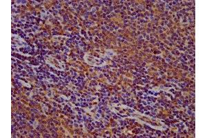IHC image of ABIN7165598 diluted at 1:500 and staining in paraffin-embedded human lymph node tissue performed on a Leica BondTM system. (FLII anticorps  (AA 577-729))