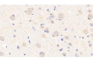 Detection of MXRA5 in Human Cerebrum Tissue using Polyclonal Antibody to Matrix Remodelling Associated Protein 5 (MXRA5) (Adlican anticorps  (AA 2542-2828))