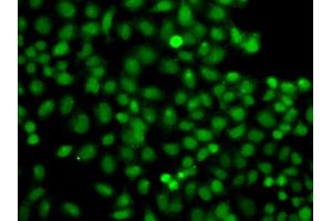 Immunofluorescence analysis of A549 cells using PIP5K1A antibody (ABIN6292233). (PIP5K1A anticorps)
